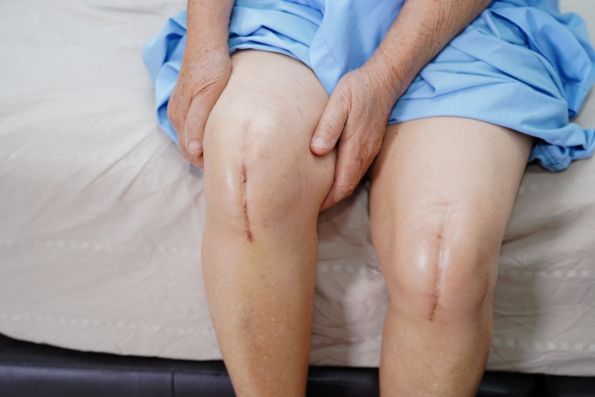 Can Same Day Knee Replacement Surgery Reduce the Risk of Joint Infection?