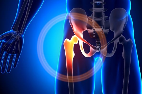 Hip Joint Dislocation: Causes, Symptoms, Treatment, and Recovery